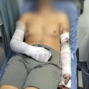 manisada sanayi sitesinde patlama 2 yarali wAsg46wD